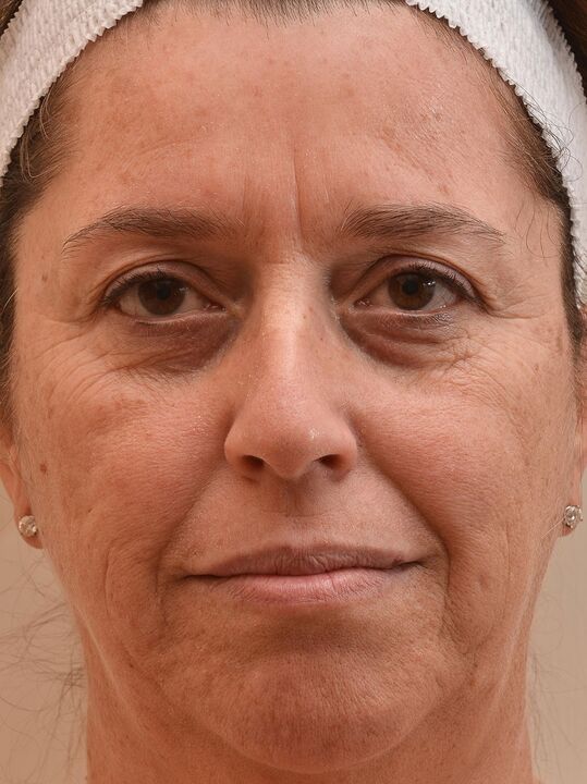 Alors j'ai regardé avant d'utiliser la crème Eudalie