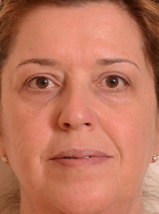 J'ai rajeuni mon visage avec Eudalie -cream