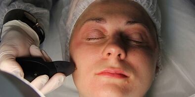 Comment se préparer au rajeunissement de la peau au plasma